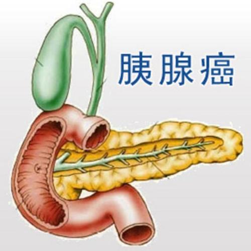 郑州看胰腺癌哪个中医好