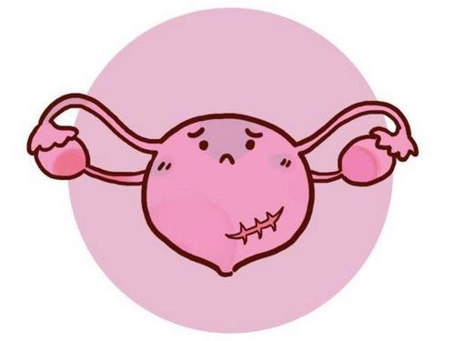 郑州中医：年轻女性患卵巢癌的原因
